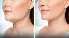 5 enkla övningar som ger ett ”lyft ansikte” utan hjälp av en hudterapeut – redan efter några veckor